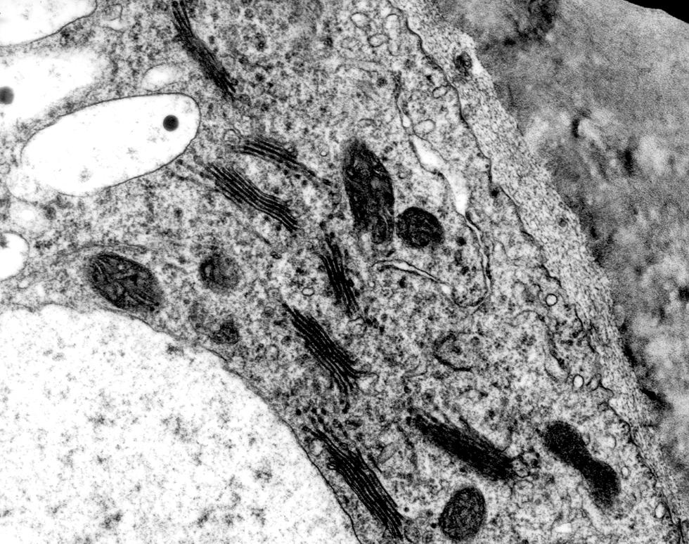Golgi apparatus